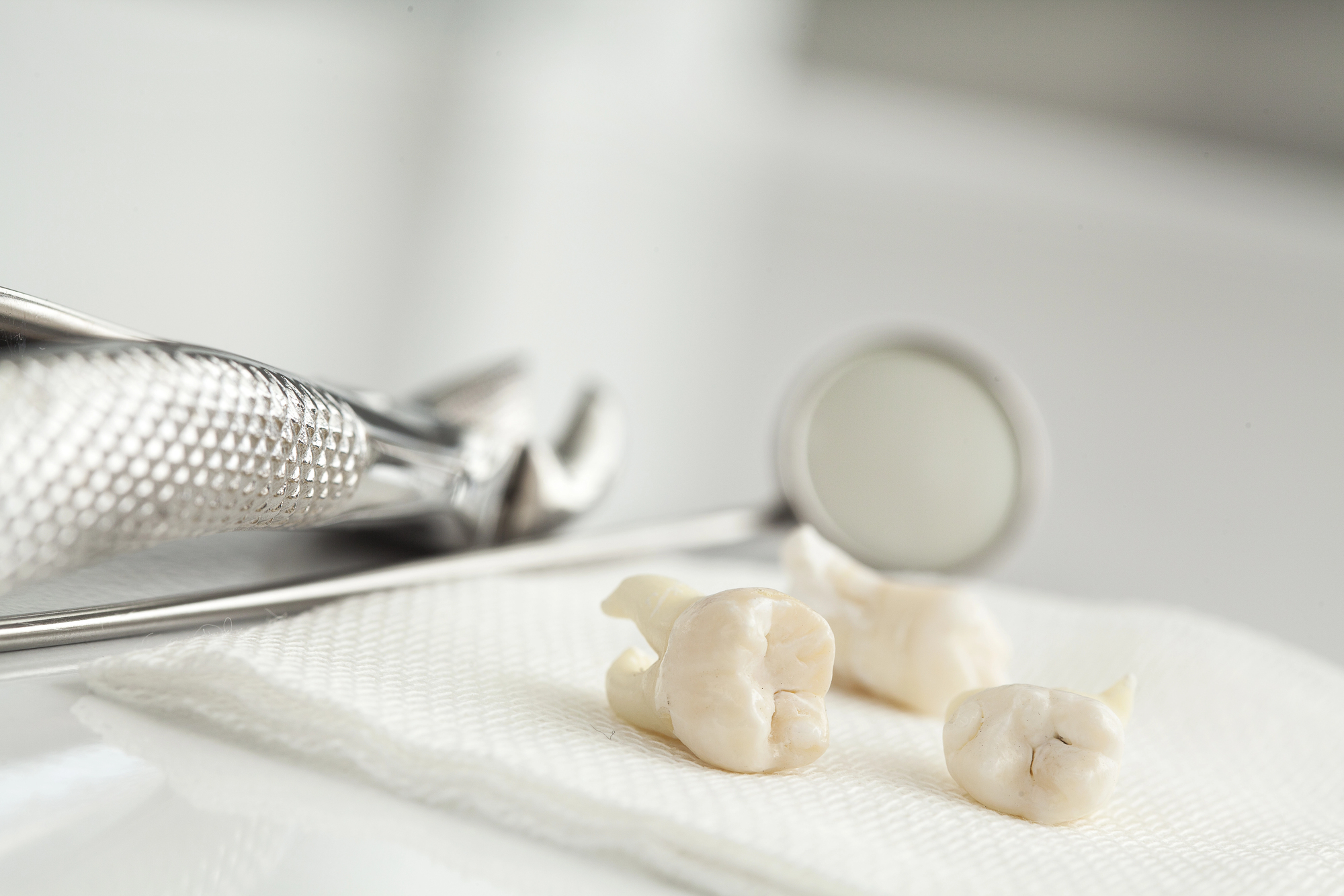 dental extraction